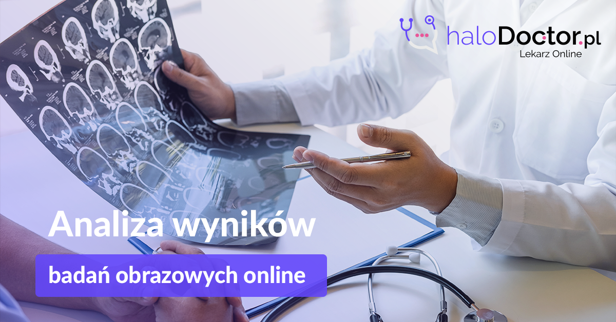 Analiza wyników badań obrazowych przez Internet