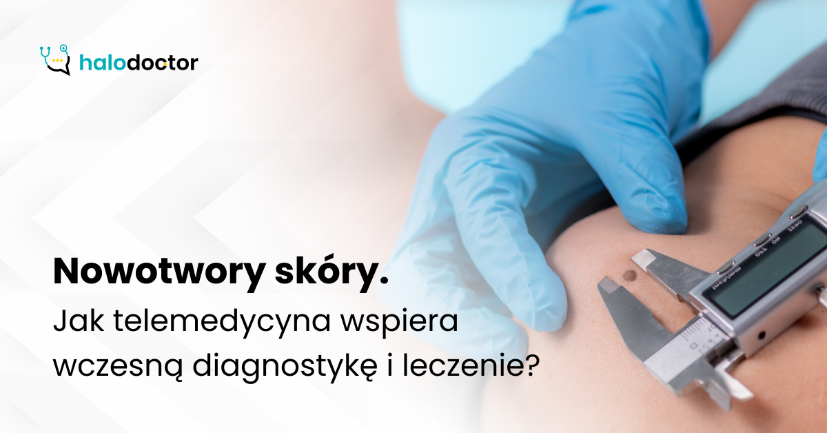 Nowotwory skóry. Jak telemedycyna wspiera wczesną diagnostykę i leczenie?