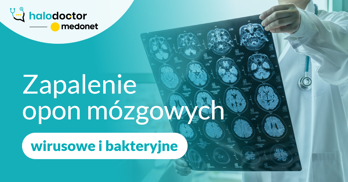 Zapalenie opon mózgowych - wirusowe i bakteryjne 