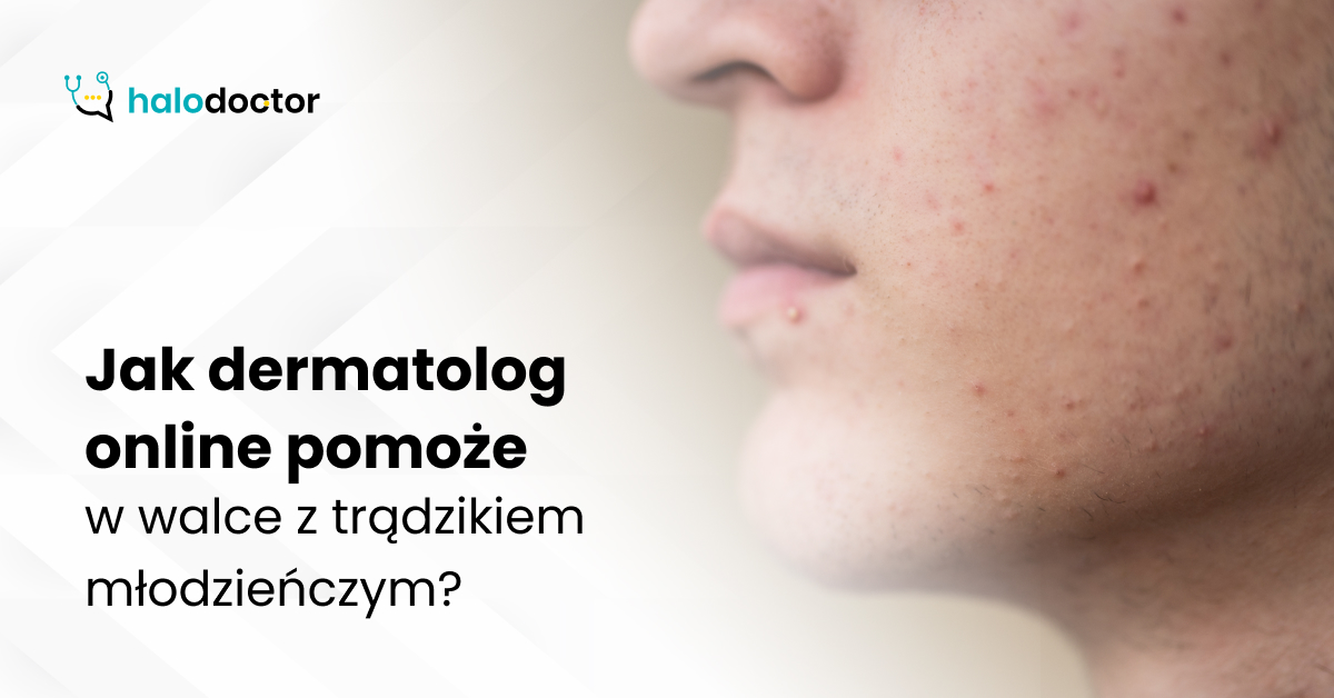 Jak dermatolog online pomoże w walce z trądzikiem młodzieńczym?