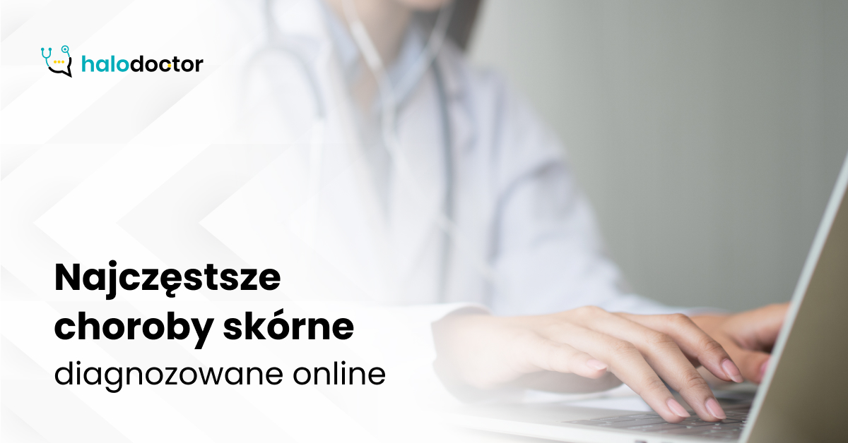 Najczęstsze choroby skórne diagnozowane online